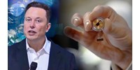 A gondolataival tudja irányítani egy számítógép egerét az első páciens, akinek egy chipet ültettek az agyába – állítja Elon Musk