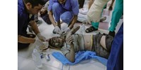  Elképesztően sok gyerek hal meg Gázában, ahol már érzéstelenítés nélkül végzik az amputációkat is  