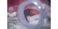  Néhány órás újszülöttet tettek a szolnoki kórház inkubátorába  