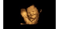  4D-s ultrahangképek szerint a méhben lévő baba mosolygó arcot vág, ha az anya répát eszik  