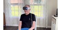 Beültették az agyába a chipet, a gondolataival vezérli az Apple Vision Prót a 64 éves beteg férfi