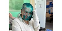  Ujjait összetörték, a fejét pedig leborotválták az orosz Novaja Gazeta oknyomozó újságírójának  