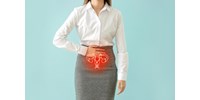  Menstruációs szabadság – igen vagy nem?  