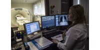 Egy magyar laboratórium újfajta tesztje megmutatja, melyik kemoterápiával jobb kezelni a rákos beteget  
