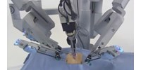 Robot is segíti a daganatos betegek kezelését a Semmelweis Egyetemen  