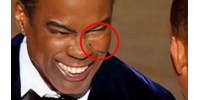  Kamu a neten terjedő kép, Chris Rock nem viselt arcvédőt, amikor Will Smith megpofozta  