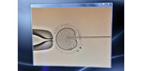  Mesterséges emberi embriót készítenének a tudósok, hogy legyen elég donorszerv  